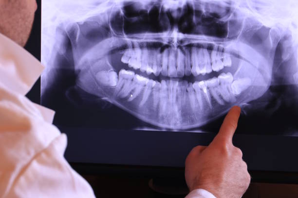 Best Broken or Cracked Tooth Emergency Dentist in Kent, OH